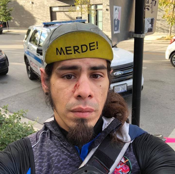 Another Case of Brutality Against a Bicyclist in West Town